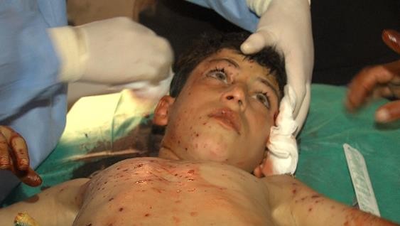 Chùm ảnh thảm họa nhân đạo trẻ em ở địa ngục Syria ảnh 7
