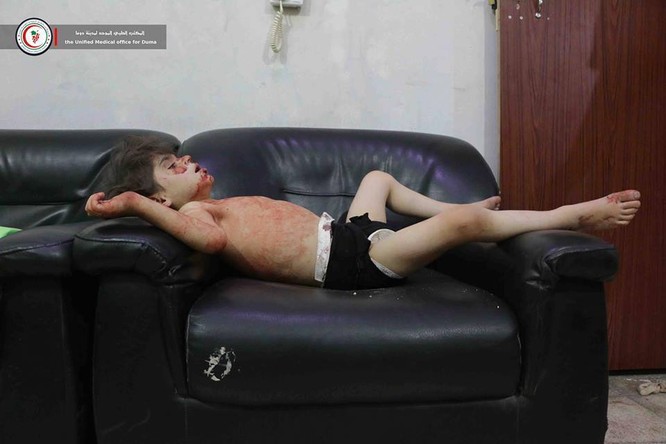 Chùm ảnh thảm họa nhân đạo trẻ em ở địa ngục Syria ảnh 8