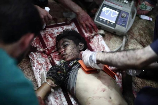 Chùm ảnh thảm họa nhân đạo trẻ em ở địa ngục Syria ảnh 19