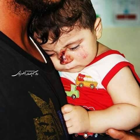 Chùm ảnh thảm họa nhân đạo trẻ em ở địa ngục Syria ảnh 23