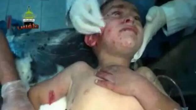 Chùm ảnh thảm họa nhân đạo trẻ em ở địa ngục Syria ảnh 37