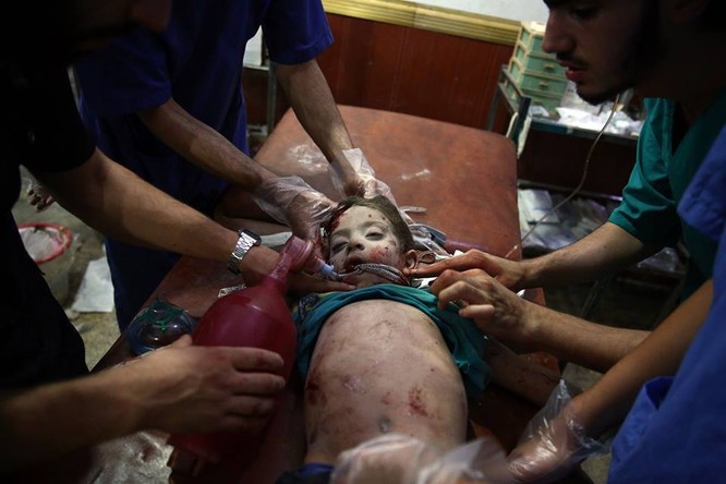 Chùm ảnh thảm họa nhân đạo trẻ em ở địa ngục Syria ảnh 46