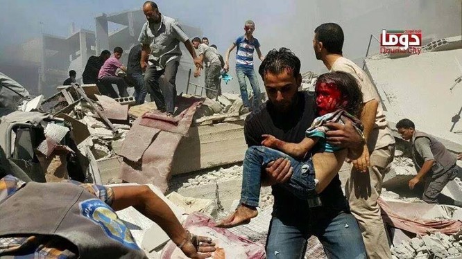 Chùm ảnh thảm họa nhân đạo trẻ em ở địa ngục Syria ảnh 47