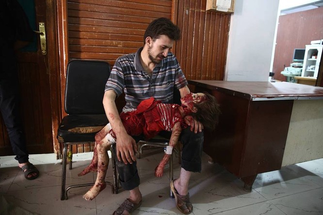 Chùm ảnh thảm họa nhân đạo trẻ em ở địa ngục Syria ảnh 53