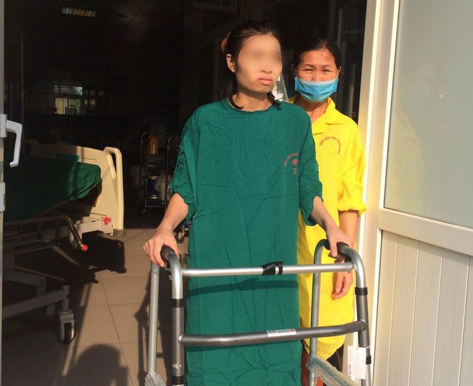 2 bệnh viện ra tay cứu cô gái trẻ bị di chứng của bệnh lao ảnh 2