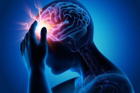 8 biểu hiện báo hiệu bạn có thể mắc u não ảnh 8