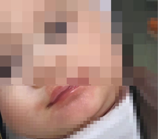 Bé gái bị sốc nặng vì uống sữa non Hàn Quốc trộn với sữa mẹ ảnh 1