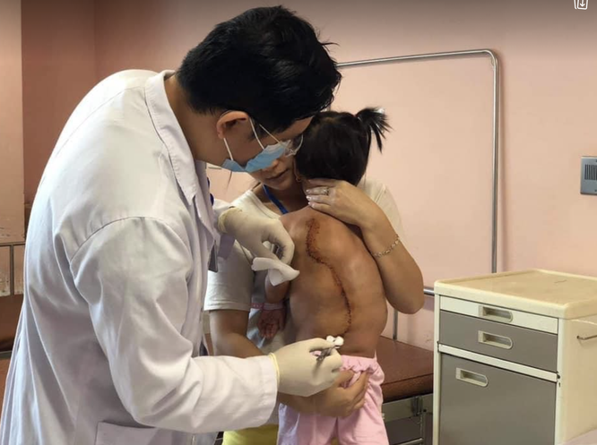Bé gái 2 tuổi chưa từng được nằm thẳng vì “cõng” khối u mỡ hiếm nặng tới 4kg ảnh 2