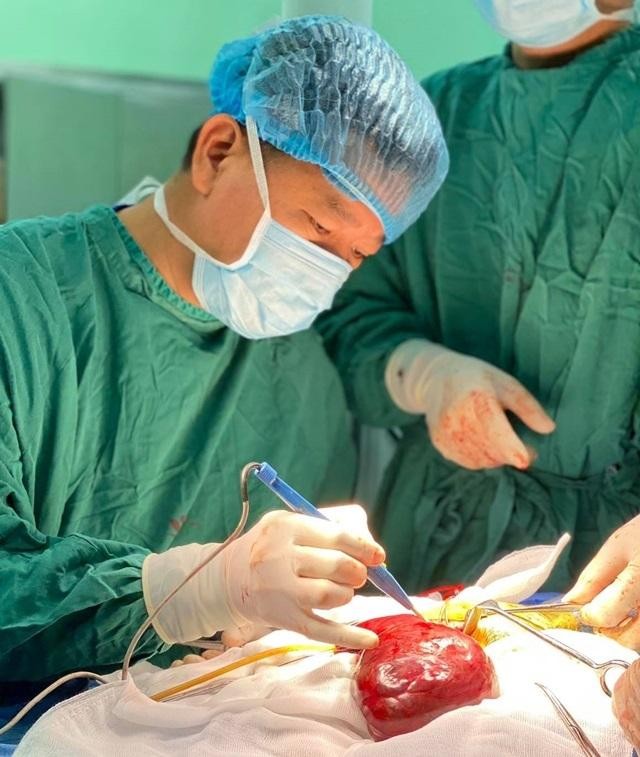 Bác sĩ toát mồ hôi cắt bỏ khối u máu khổng lồ ở gan bé trai mới 14 ngày tuổi ảnh 1
