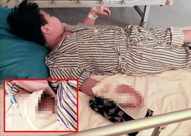 Những hình ảnh hãi hùng do trẻ em nghịch pháo ở Trung Quốc ảnh 1
