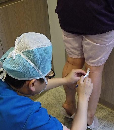 Phong tỏa bắp chân – trào lưu làm đẹp đáng sợ của các thiếu nữ Trung Quốc ảnh 2