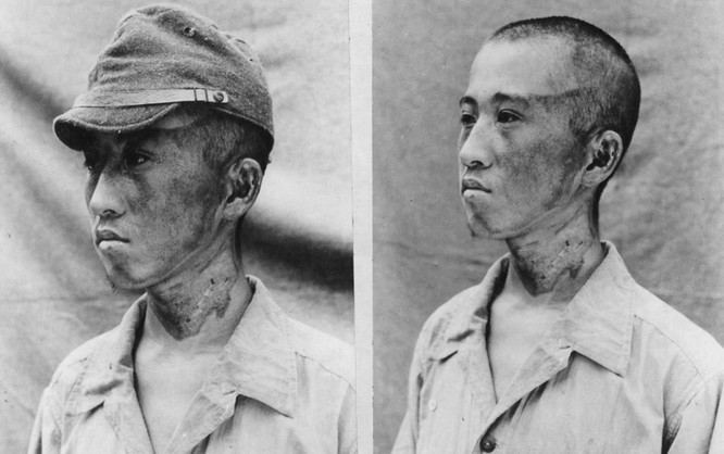 Chùm ảnh độc thảm họa hạt nhân Hirosima 70 năm trước ảnh 20