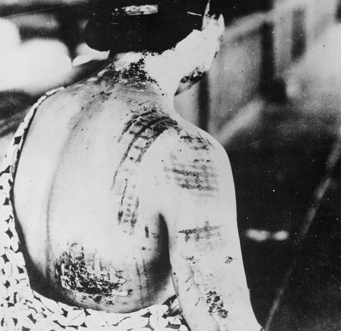 Chùm ảnh độc thảm họa hạt nhân Hirosima 70 năm trước ảnh 28