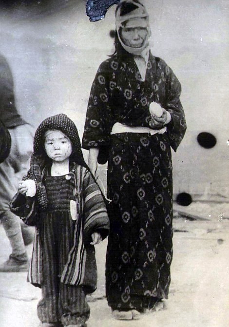Chùm ảnh độc thảm họa hạt nhân Hirosima 70 năm trước ảnh 42