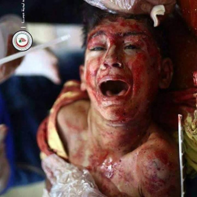 Chùm ảnh thảm họa nhân đạo trẻ em ở địa ngục Syria ảnh 2