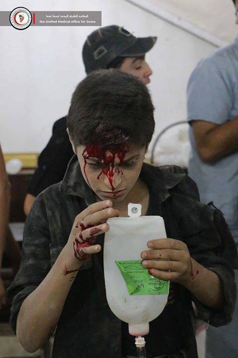 Chùm ảnh thảm họa nhân đạo trẻ em ở địa ngục Syria ảnh 10