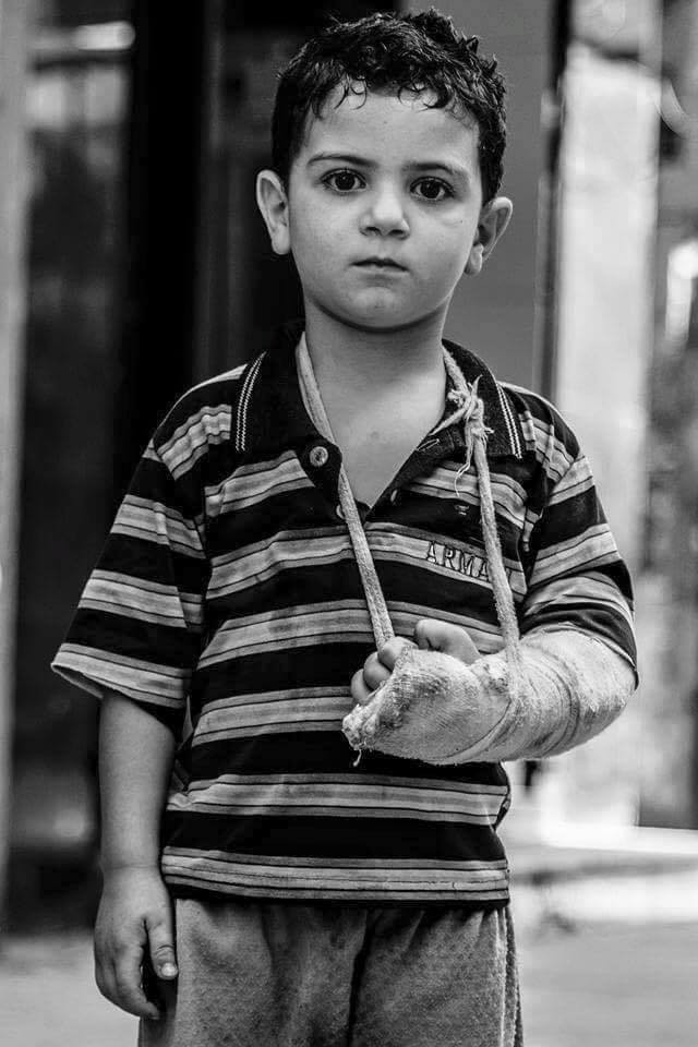 Chùm ảnh thảm họa nhân đạo trẻ em ở địa ngục Syria ảnh 29