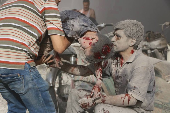 Chùm ảnh thảm họa nhân đạo trẻ em ở địa ngục Syria ảnh 34