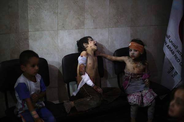 Chùm ảnh thảm họa nhân đạo trẻ em ở địa ngục Syria ảnh 57