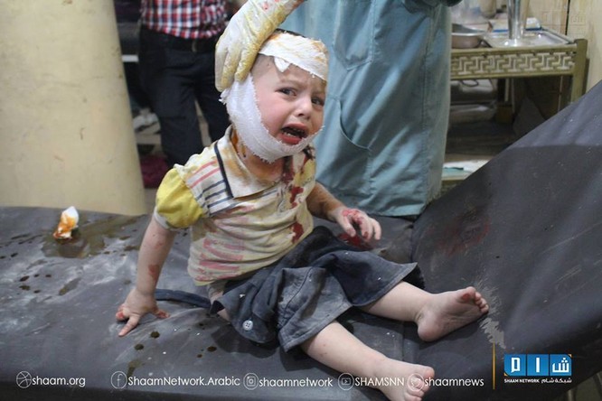 Chùm ảnh thảm họa nhân đạo trẻ em ở địa ngục Syria ảnh 59