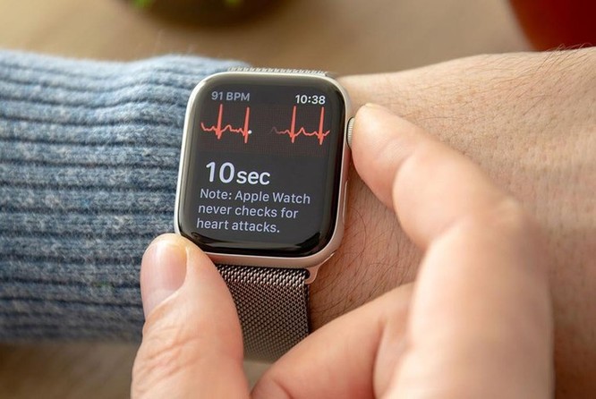 Đây là lý do tôi không dùng Apple Watch hay bất cứ smartwatch nào khác ảnh 2