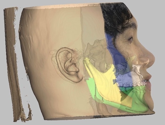 Công nghệ 3D giúp "tu sửa" gương mặt đặc biệt cho chàng trai ảnh 1