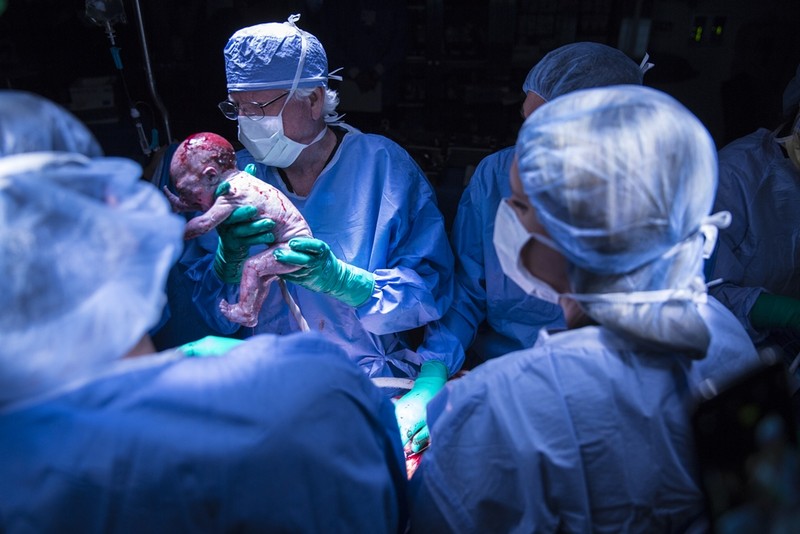 Em bé đầu tiên được sinh ra nhờ phương pháp cấy ghép tử cung. Ảnh: Time.com