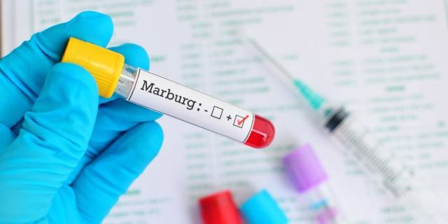 Virus Marburg khiến 9 người chết và WHO lập tức phải họp khẩn (ảnh: Bimbisaniebelli)