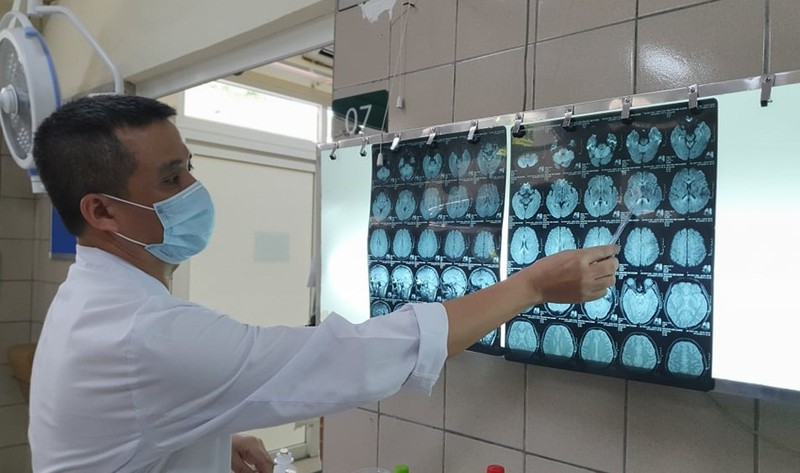 Bác sĩ xem phim chụp cộng hưởng từ sọ não của bệnh nhân bị nhiễm độc thiếc (Ảnh: Bệnh viện Bạch Mai) 
