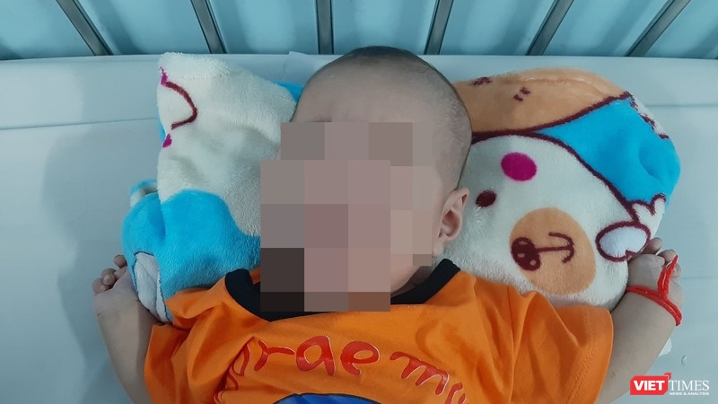 Bé trai 3 tháng tuổi bị tràn dịch phổi, nguy kịch tính mạng