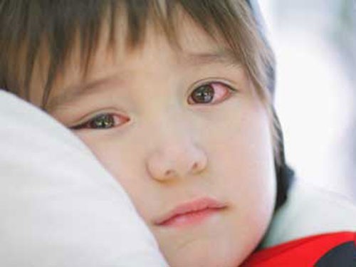 Rất nhiều trẻ em đã phải nhập viện điều trị vì đau mắt đỏ