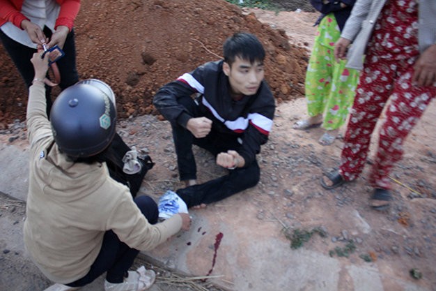 Một nạn nhân tại thị trấn Đắk Hà bị xe điên tông đang ngồi bên vệ đường đợi xe cấp cứu - Ảnh do bạn đọc cung cấp