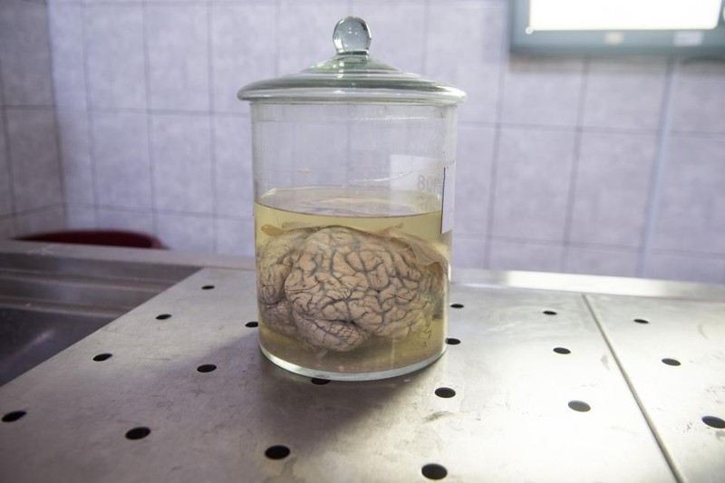 Một bộ não người được ngâm trong chất Formaldehyde, trưng bày tại Bảo tàng Neuropathology ở Lima, Peru (ảnh: Newsweek)