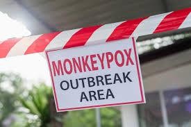 WHO tuyên bố đợt bùng phát dịch đậu mùa khỉ là tình trạng khẩn cấp y tế toàn cầu (Ảnh: SciTechDaily)