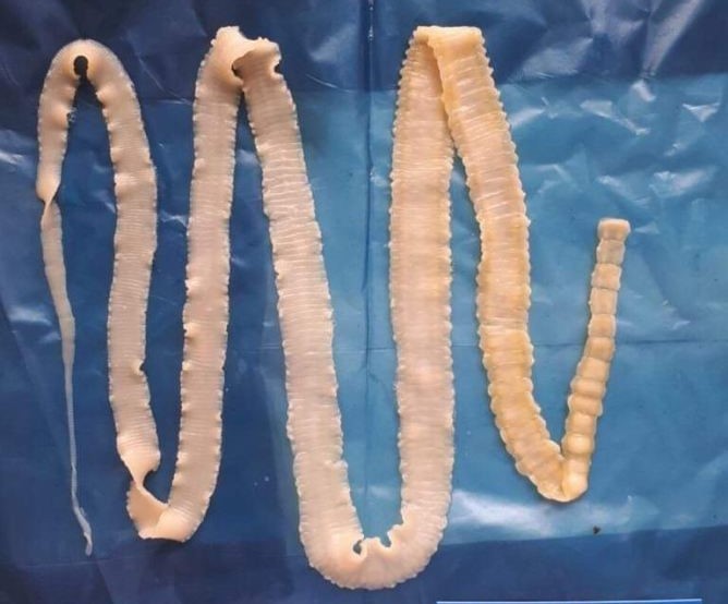 Mẫu sán dây của Viện sốt rét - Ký sinh trùng - Côn trùng TP Hồ Chí Minh