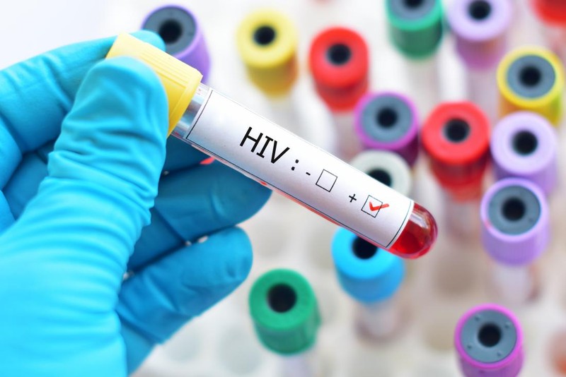 Nghiên cứu mới làm dấy lên hy vọng về một liệu pháp loại bỏ hoàn toàn virus HIV khỏi cơ thể người (Ảnh: Getty)