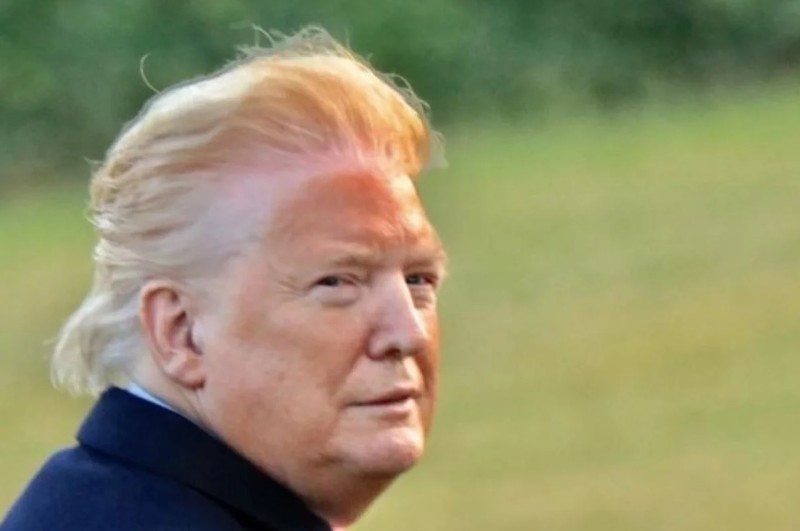 Bức ảnh chụp của William Moon cho thấy da mặt ông Trump có màu da cam, cùng một đường viền màu trắng chạy dọc chân tóc (Ảnh: William Moon)