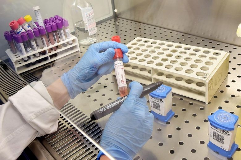 Phòng thí nghiệm chuẩn bị xét nghiệm Coronavirus. Ảnh: EPA-EFE