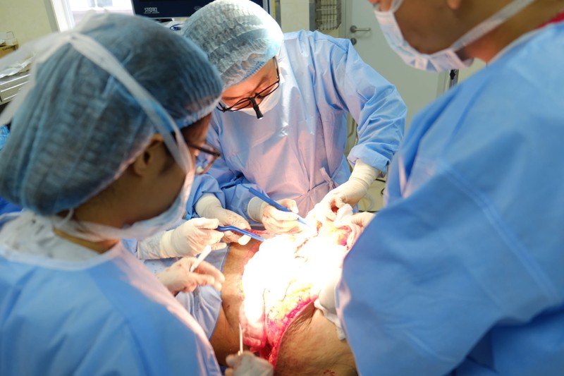 Các bác sĩ phẫu thuật cắt da thừa, mỡ bụng cho bệnh nhân bị béo phì nặng tới 115kg (Ảnh: BS. Nguyễn Đình Minh) 