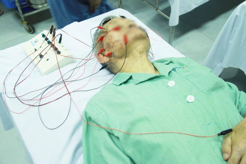 Bệnh nhân bị liệt mặt điều trị ở bệnh viện (Ảnh: BVCC)