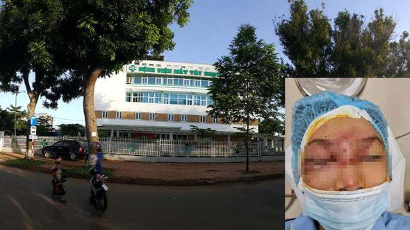 Bé trai 14 tuổi được cấp cứu ở Bệnh viện Mắt Tây Nguyên
