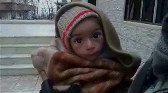 Một đứa trẻ bị suy dinh dưỡng nặng ở Madaya. Ảnh: Reuters