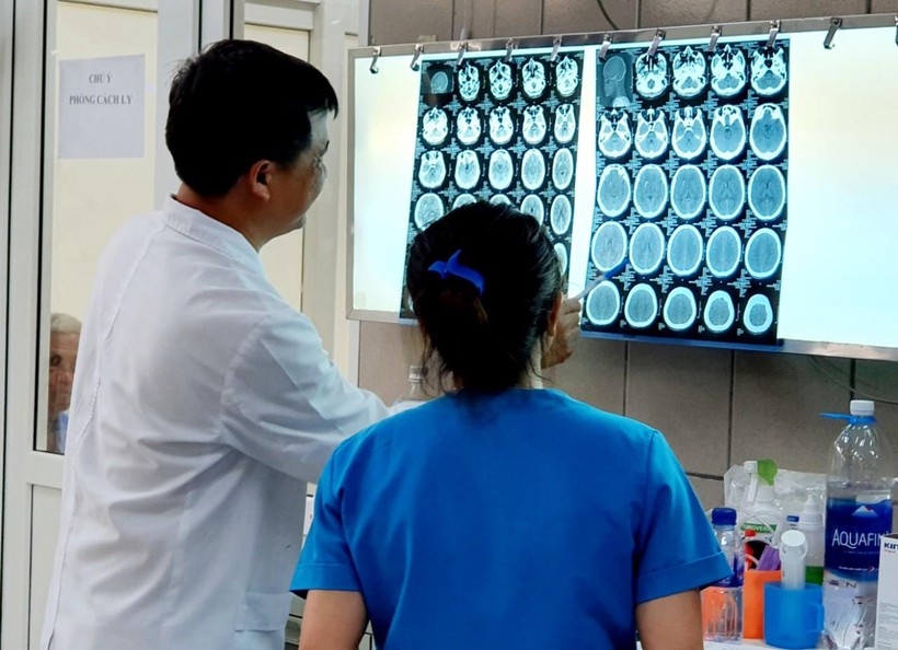 Hình ảnh phim chụp não bệnh nhân bị xuất huyết do ngộ độc ma túy đá