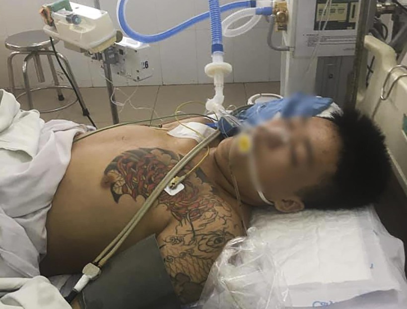 Trần Văn Hiền đang được điều trị tích cực tại Bệnh viện Đà Nẵng
