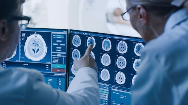 Intel cùng nhiều tổ chức nghiên cứu và chăm sóc sức khỏe trên thế giới muốn phát triển một mô hình AI đào tạo giúp phát hiện các khối u não. Ảnh: Engadget