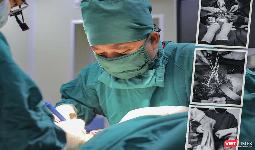 Các bác sĩ Bệnh viện đa khoa Đức Giang (Hà Nội) đang phẫu thuật nối chân cho bệnh nhân