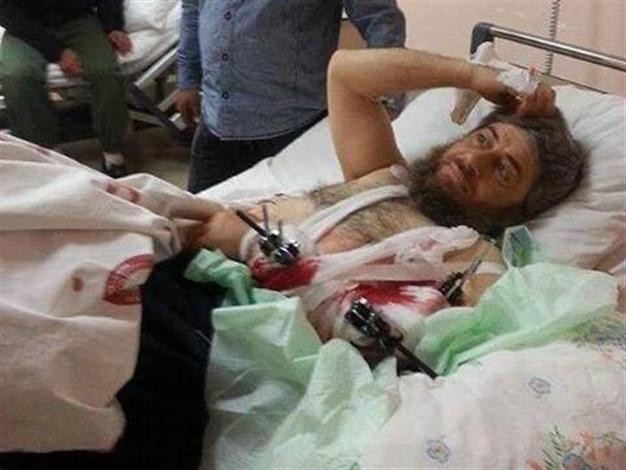 Chỉ huy chiến trường IS có tên là Abu Muhammad, 16.04.2014, đang  điều trị miễn phí tại Bệnh viện nhà nước bang Hatay sau khi bị thương trong chiến trận ở Idlib, Syria. Có vẻ được chăm sóc khá chu đáo.