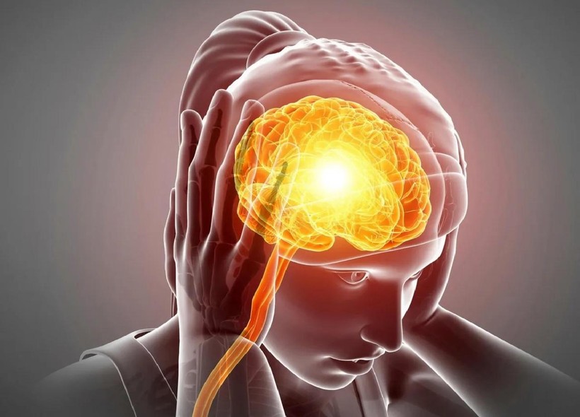 Châm cứu làm giảm số ngày đau của bệnh đau đầu căng thẳng mãn tính. Ảnh SciTechDaily