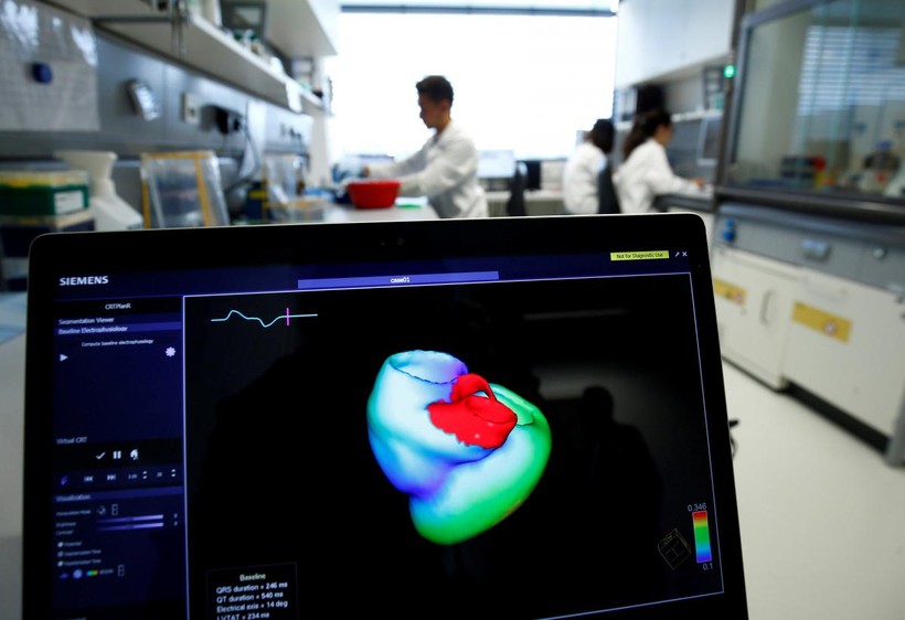 Một màn hình hiển thị hình ảnh ba chiều về trái tim con người tại Viện Tim mạch tính toán tích hợp Klaus-Tschira, khoa Bệnh viện Đại học Heidelberg (Universitaetsklinikum Heidelberg), tại Heidelberg, Đức, ngày 14/8/2018. Ảnh: REUTERS