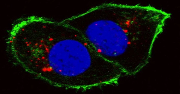 Tế bào ung thư thận (Ảnh Viện nghiên cứu ung thư quốc gia/Đại học Stanford)